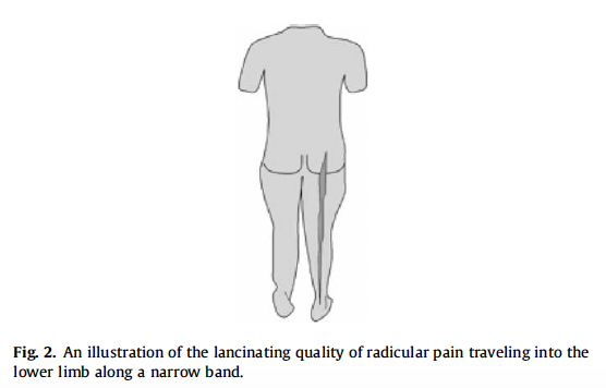 Sciatica or pain down the leg